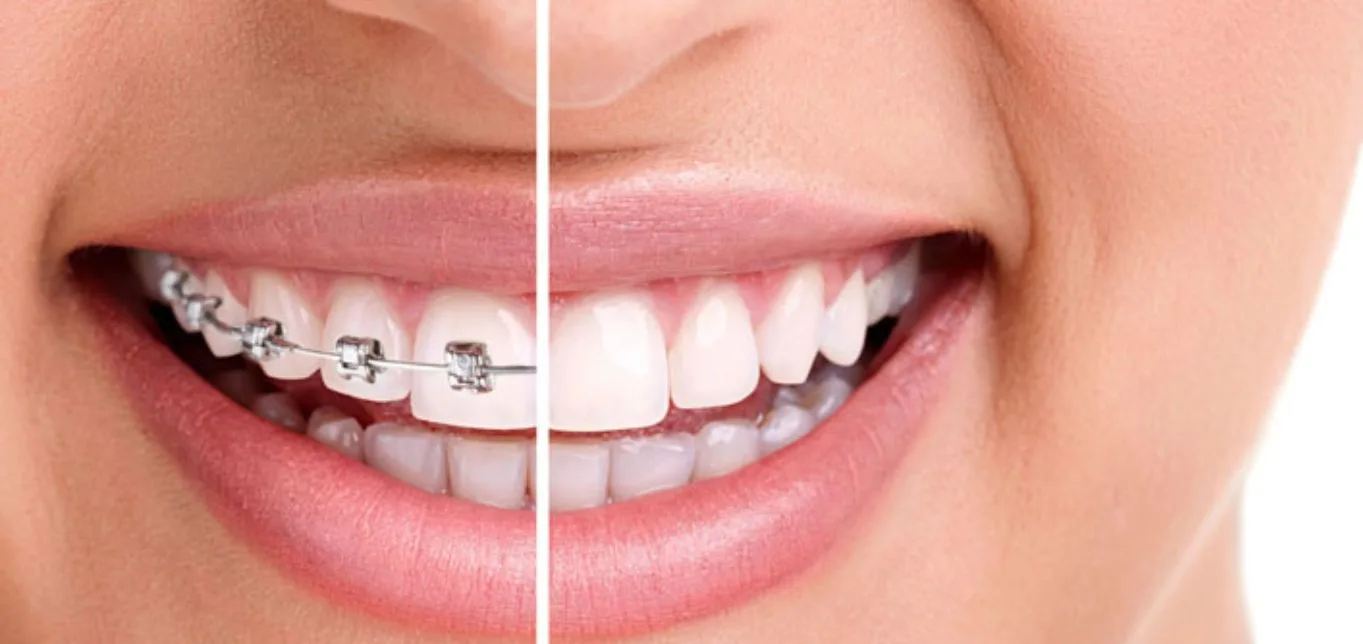 smile nobel clinic dental
