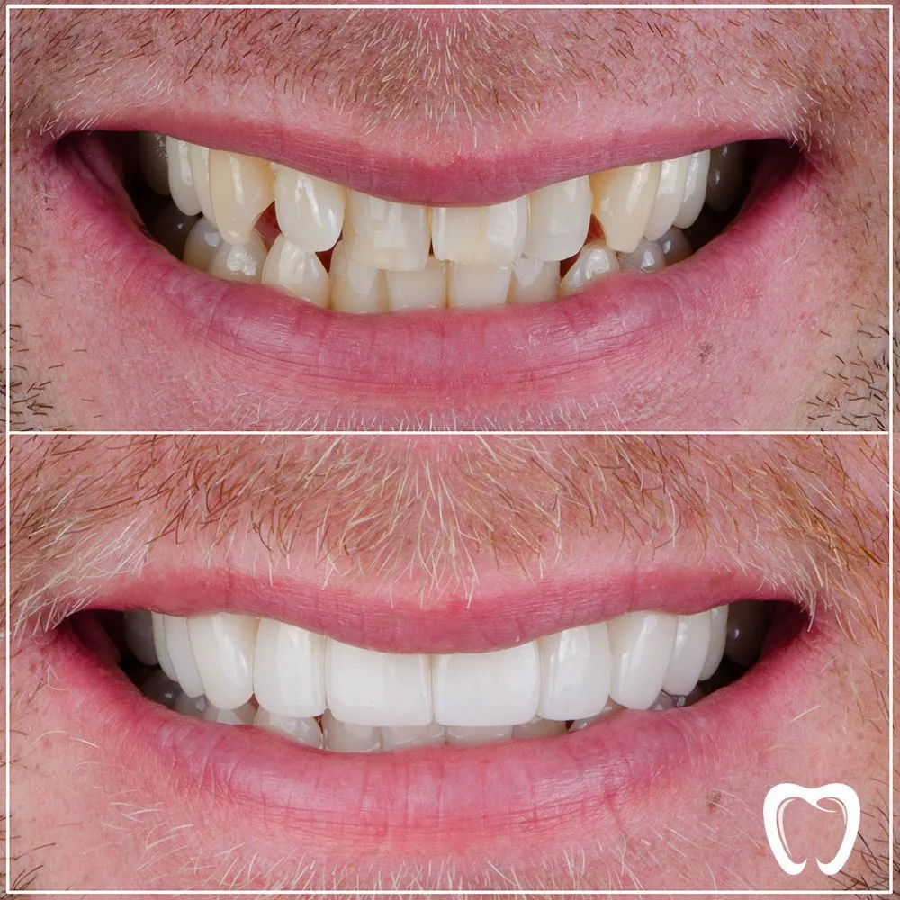 smile nobel clinic dental